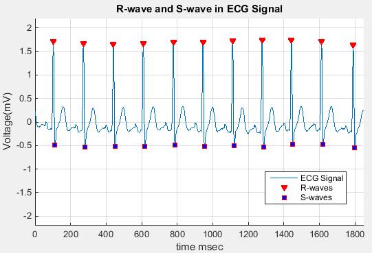 ecg signal matlab code pdf